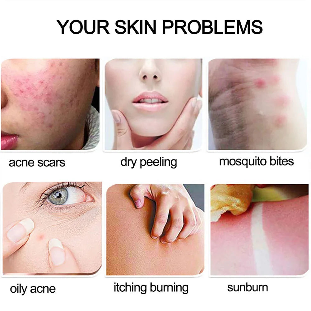 99% Aloe Vera Gel Moisturing Skin Face Cream Shrink Pores Day Cream Skincare Sleeping Mask Korean Skin Care Products 300g